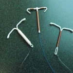 آی یو دی (IUD)